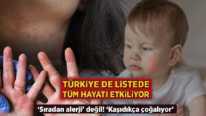 turkiye de listede tum hayati kotu etkiliyor siradan alerji degil kasidikca cogalir Q44ZridQ.jpg